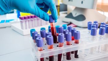 cancer testing test blood work